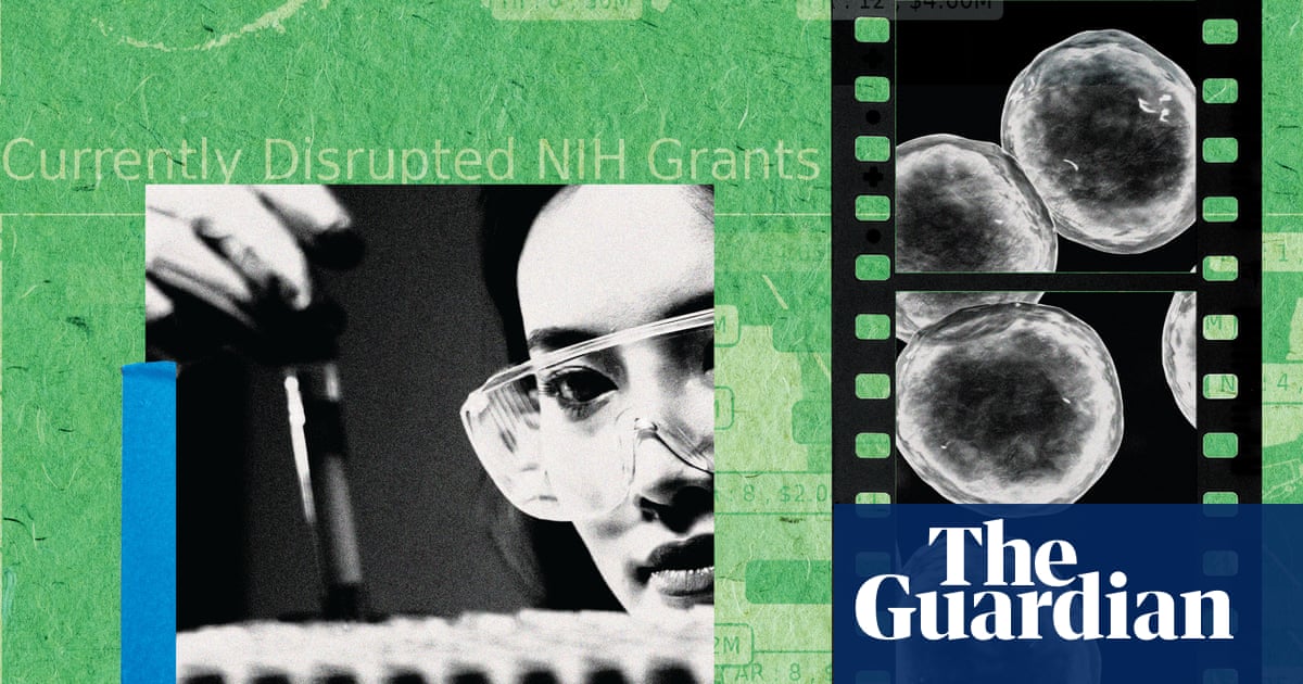 We're no longer attracting top talent: the brain drain killing American science